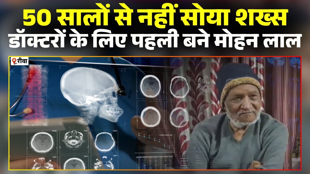 Rewa Amazing News: A man who hasn't slept for 50 years, Mohan Lal, has become a mystery to medica...