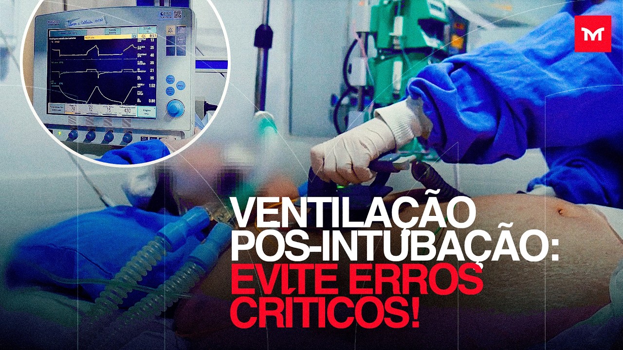 Você Está Errando na Intubação? Descubra os Segredos que Poucos Médicos Revelam!