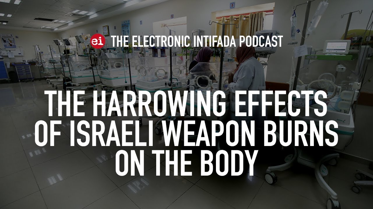 The harrowing effects of Israeli weapon burns on the body, with Dr. Tarek Loubani