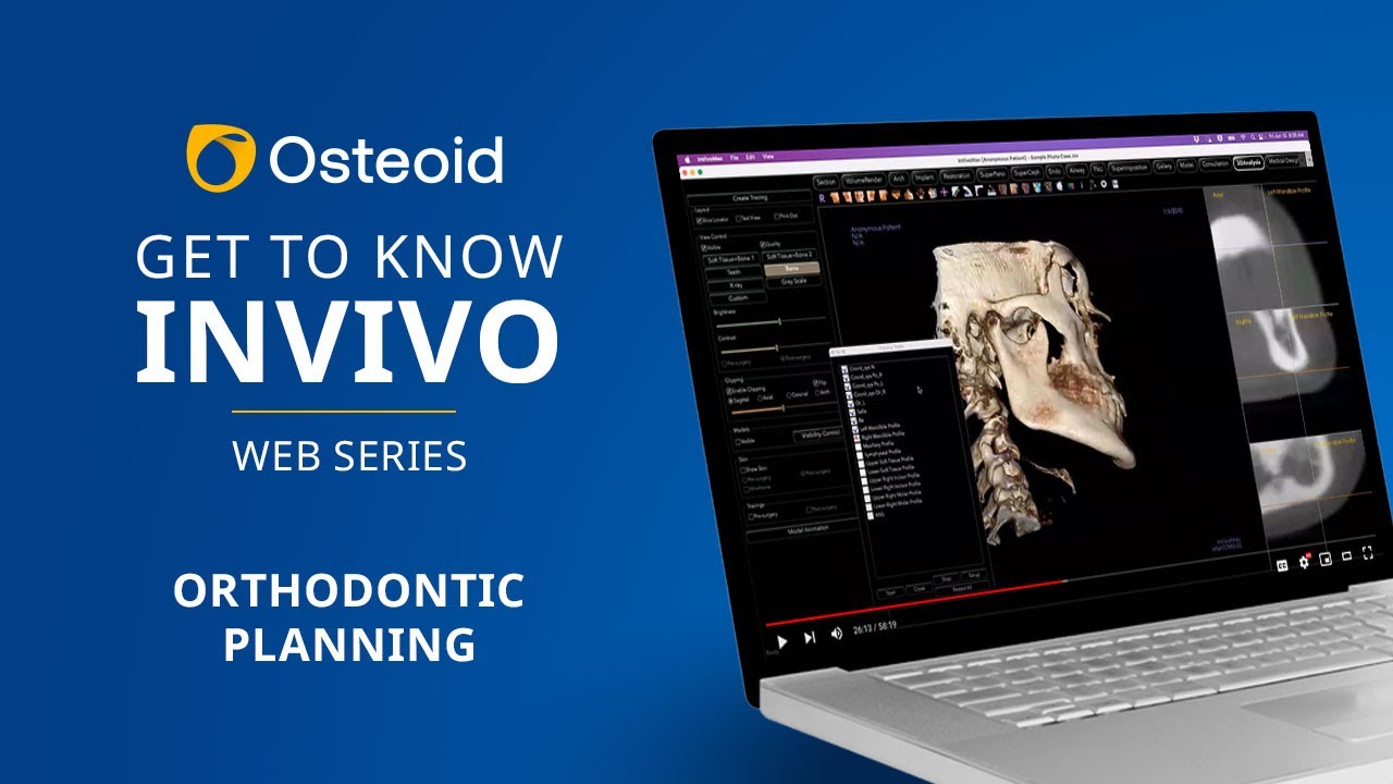 Webinar: Get to Know Invivo - Orthodontic Planning