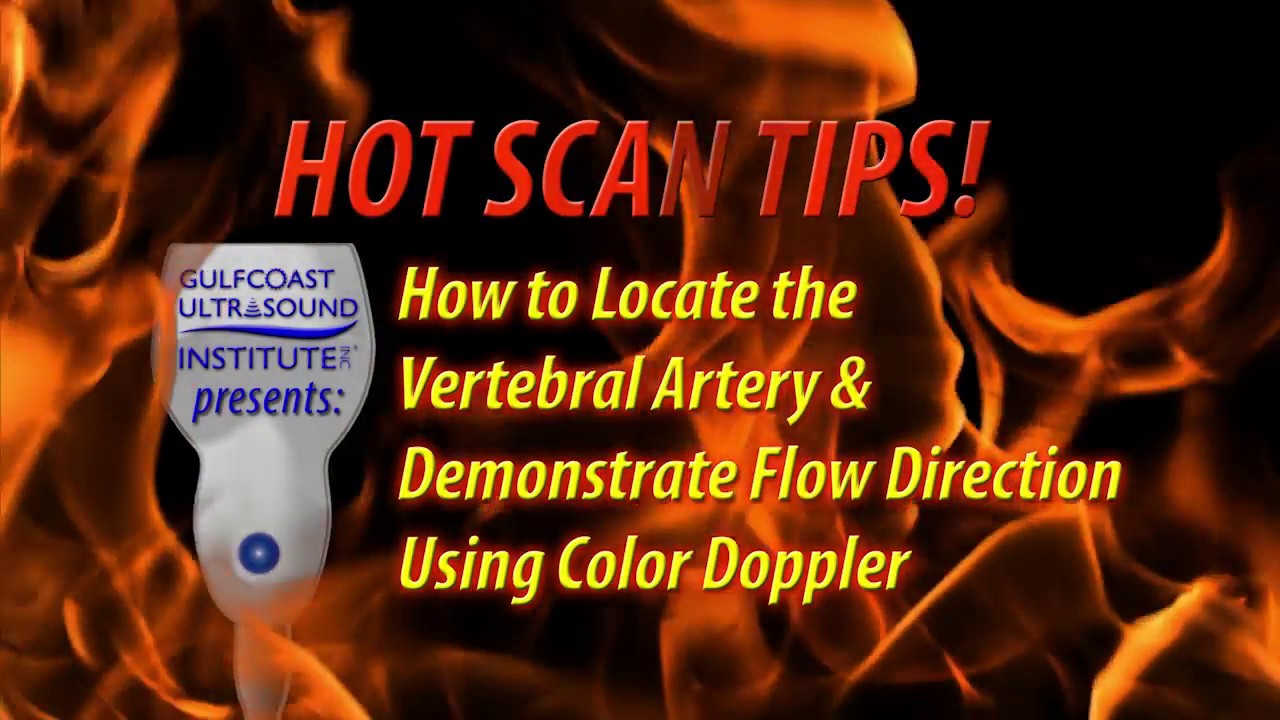 Hot Tip-How to Locate the Vertebral Artery and Demonstrate Flow Direction