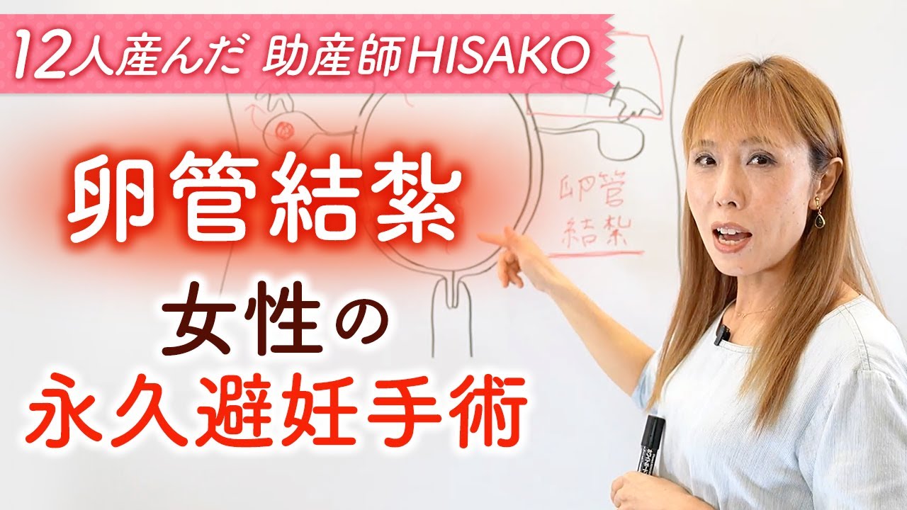 【卵管結紮】　女性の永久避妊手術