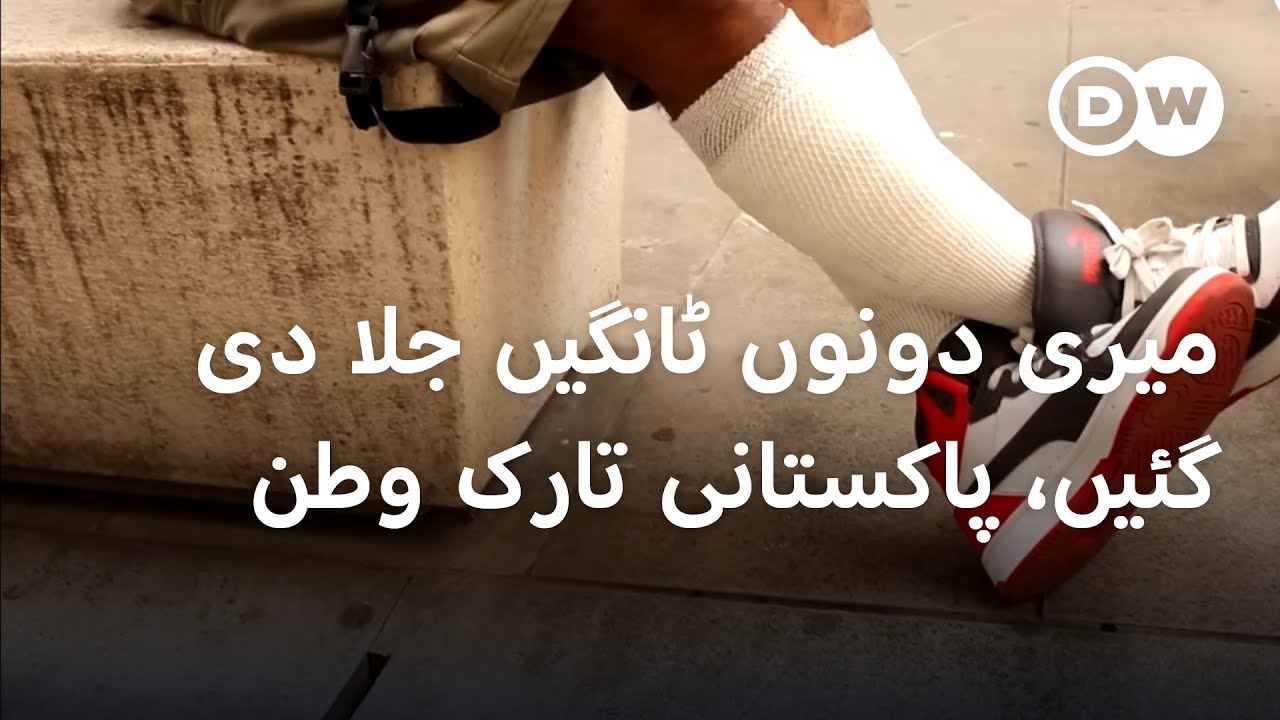 زخمی پاکستانی تارک وطن کا دکھ بانٹتے اطالوی شہری | DW Urdu | Burned but Unbroken: Arif's Story