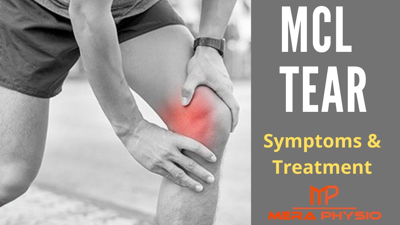 MCL Tear | Medial Collateral Ligament | Symptoms, Treatment, Exercises | In Hindi | Mera Physio