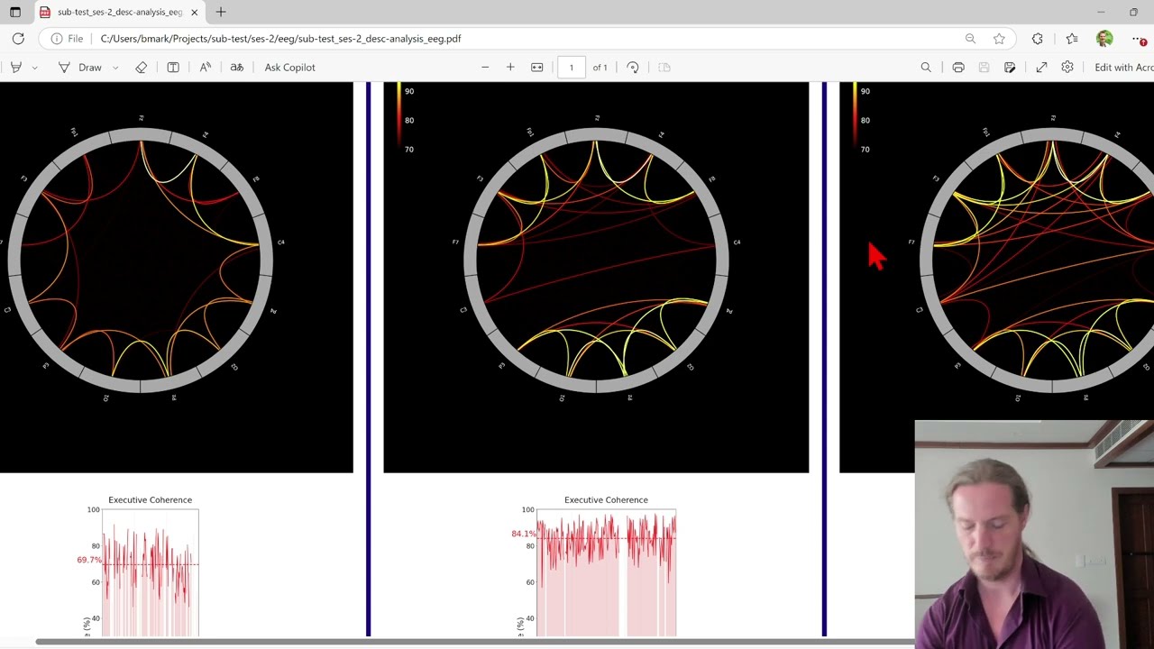 Movement EEG report demo