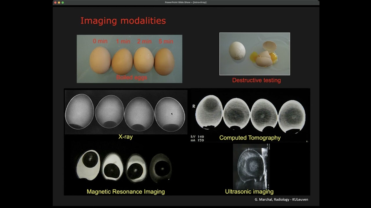 Medical Imaging Modalities - X-ray Imaging