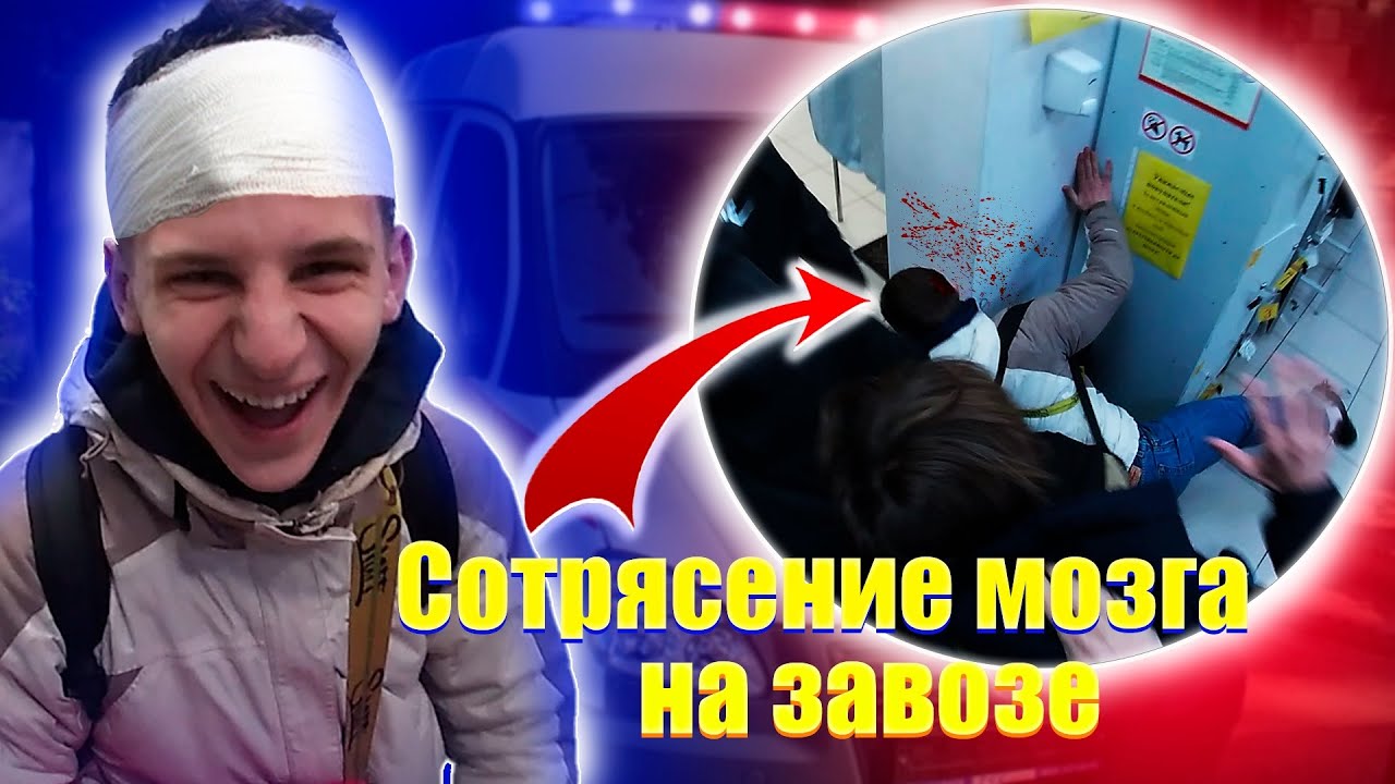 СОТРЯСЕНИЕ МОЗГА НА ЗАВОЗЕ УПАЛ В СТЕНУ ГОЛОВОЙ