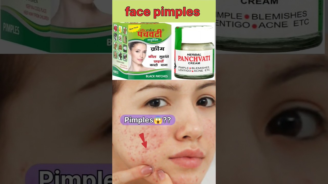 चहरे में Pimple 😱 #Panchvati Cream #shorts