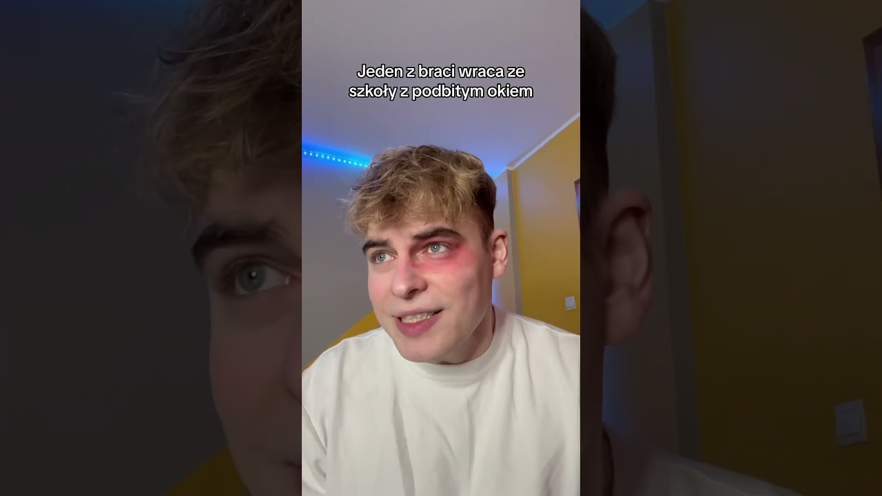 JA JAKO OJCIEC - podbite oko