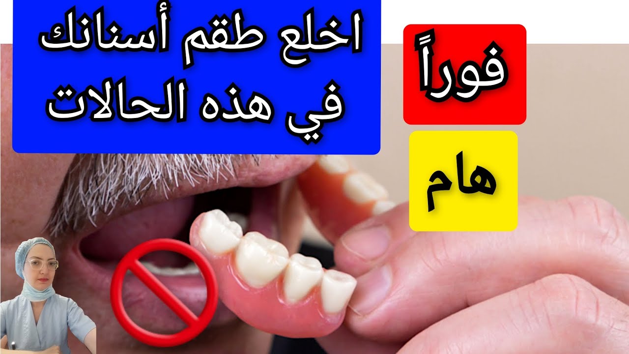 الحالات التي يجب فيها خلع طقم الأسنان فوراً. تركيبات الأسنان المتحركة الكاملة و الجزئية  Dentier