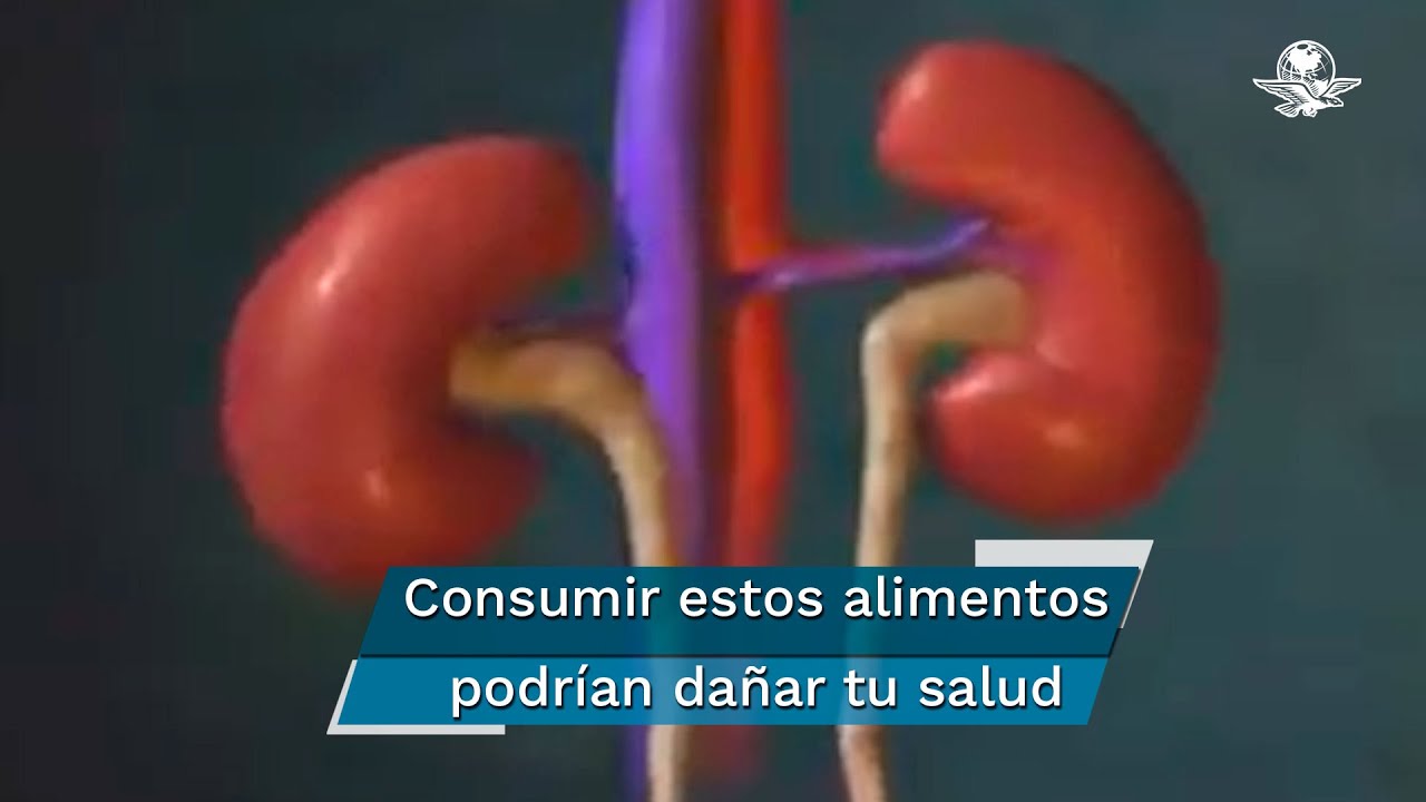 5 Alimentos que da&ntilde;an los ri&ntilde;ones