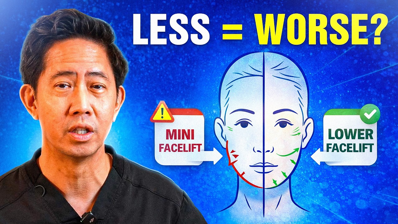 Thinking About a Mini Facelift? Here’s When It Works—and When It Fails