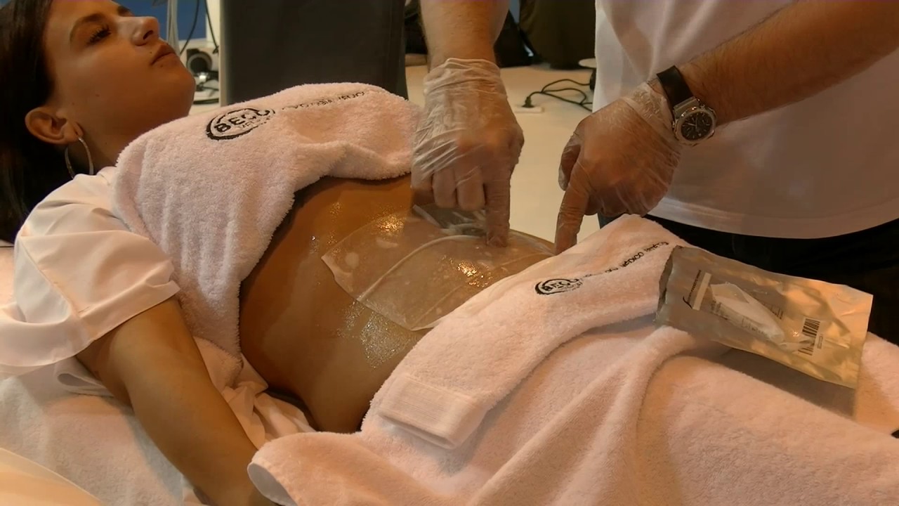 Criolipolisis - Onda de Choque Radial - Demostración Cryo Cool Med + Adipo Wave - - (Castellano)