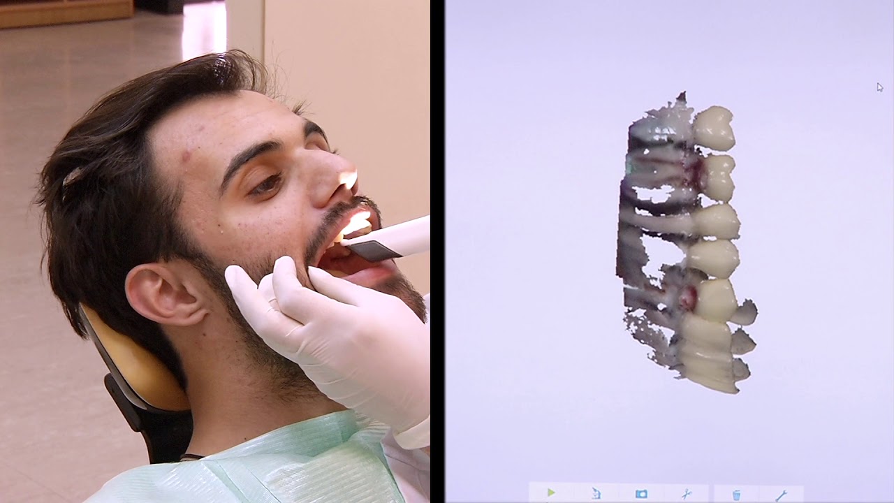 طابعات ثلاثية الابعاد لانتاج قوالب في طب الأسنان - 4Tech