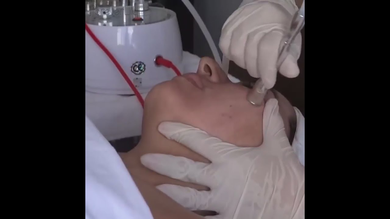 Foreverlily Microdermabrasion Dermabrasion Machine Face Peeling Machine (link in the description)