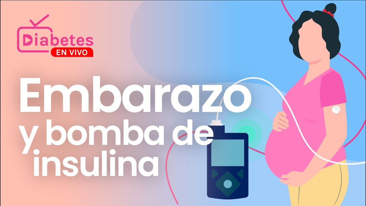 Diabetes en Vivo - Embarazo y bomba de insulina