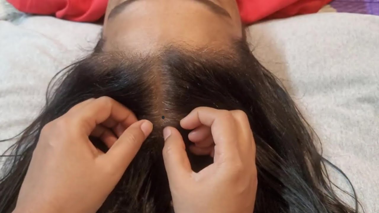 ASMR Scalp Check: The Most Relaxing Experience🌿✨