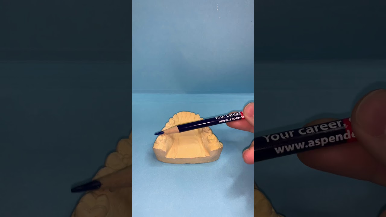 How to Bend a Lower Lingual Holding Arch