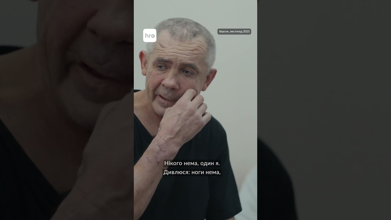 &laquo;Дивлюсь, ногу до коліна вирвало. Кров аж бризками&raquo; / hromadske