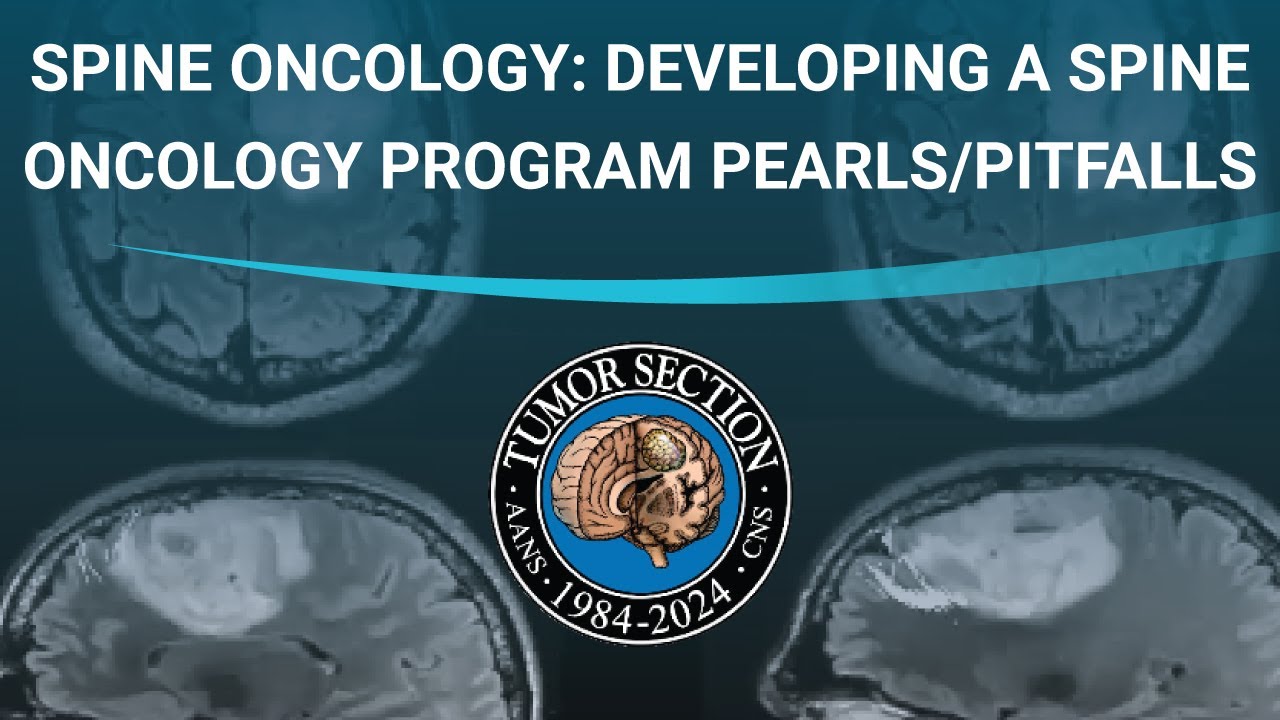 AANS/CNS Section on Tumors - Spine Oncology: Developing a Spine Oncology Program Pearls/Pitfalls