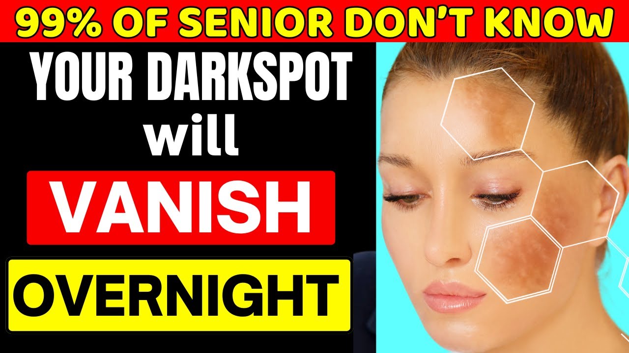 Seniors: Erase Dark Spots Overnight With THIS 1 Remedy – Dermatologists Shocked!