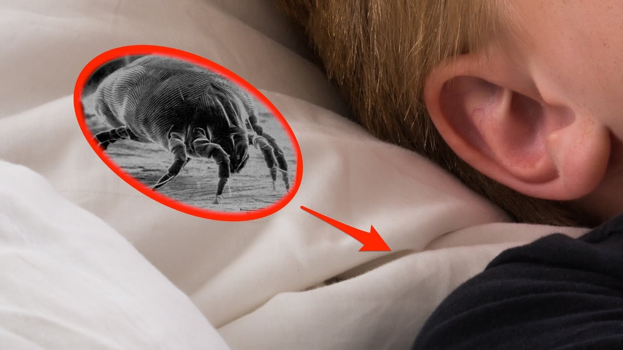 Turns out your pillow may be causing your allergies