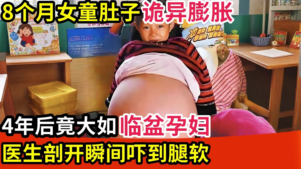 8个月女童肚子诡异膨胀!4年后竟大如临盆孕妇,医生剖开瞬间吓到腿软【纪实故事】