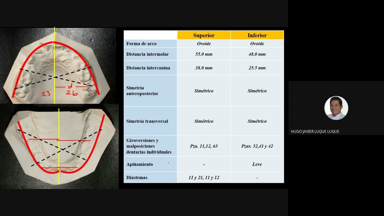 9 Diapositivas Modelos de Estudio