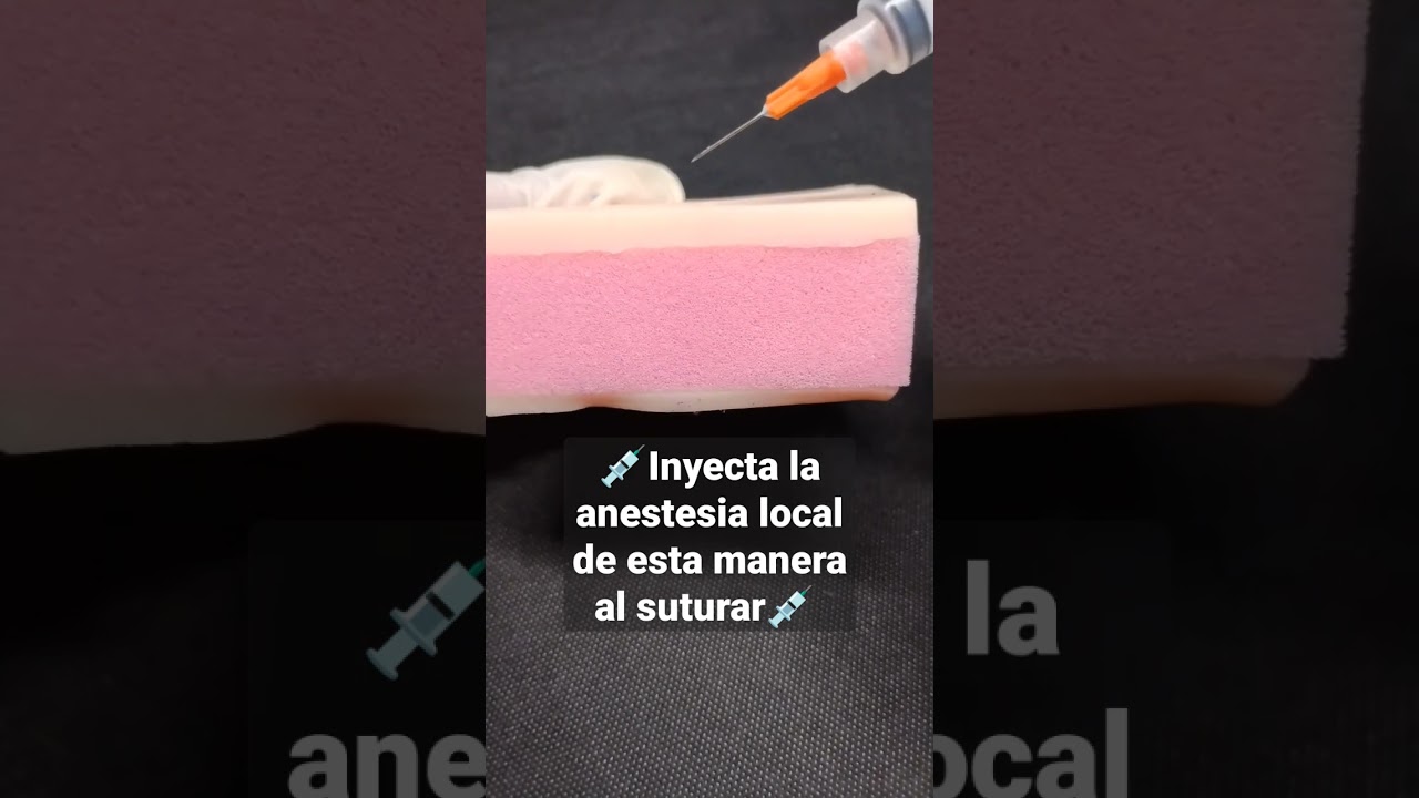 Aplica la anestesia local de esta manera al suturar piel