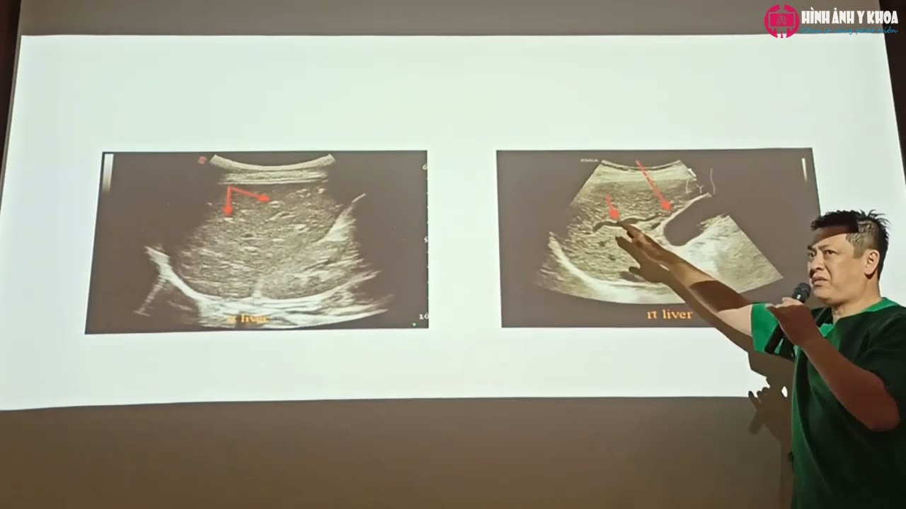 04. Thuật ngữ siêu âm - ThS.BS Nguyễn Quang Thái Dương (SATQ ĐHYD)