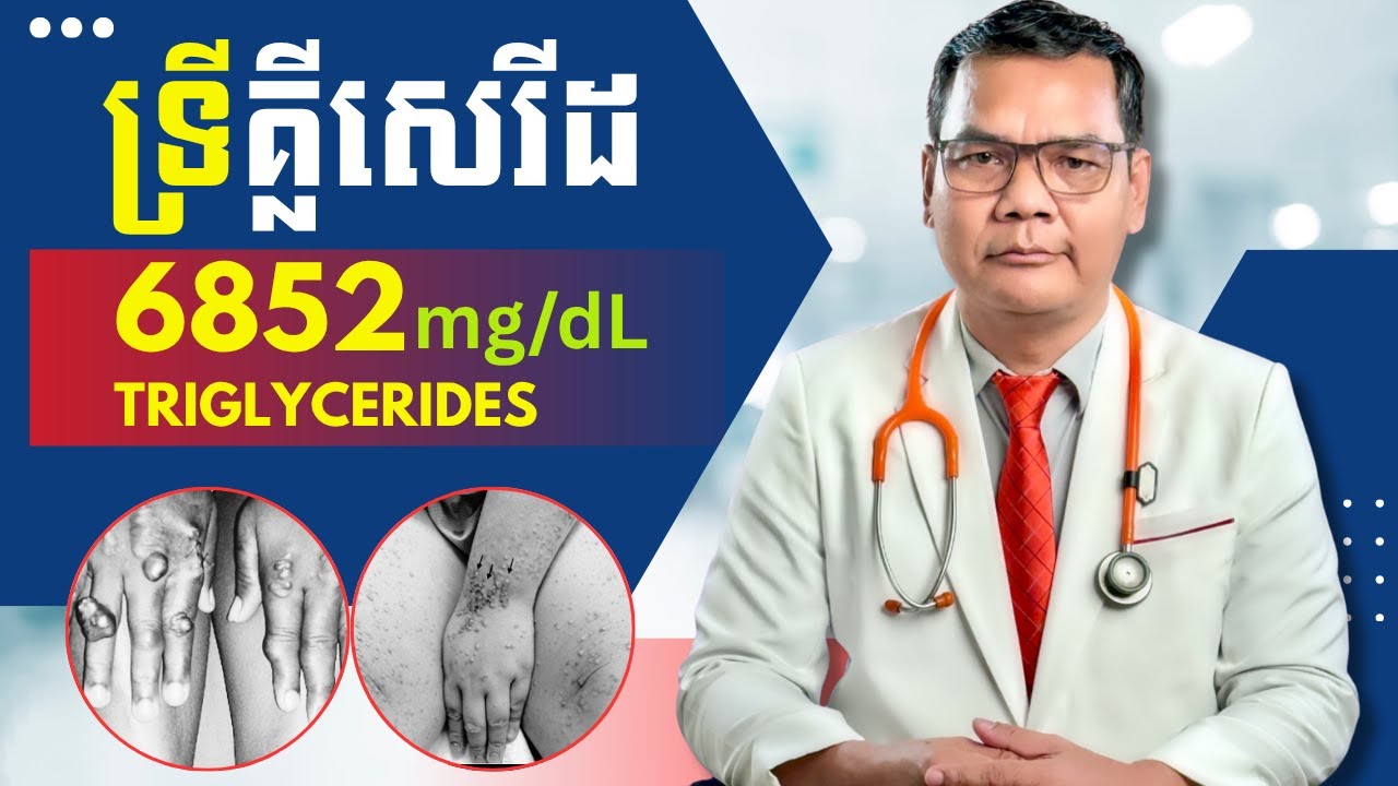 ទ្រីគ្លីសេរីដ 6852 mg/dL Triglycerides