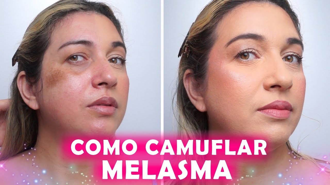 COMO ESCONDER MELASMA COM MAQUIAGEM - TRUQUES DE MAQUIADORA ✨