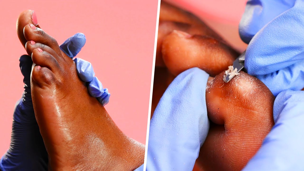 Extremely SATISFYING Pedicure Transformation - Foot Care