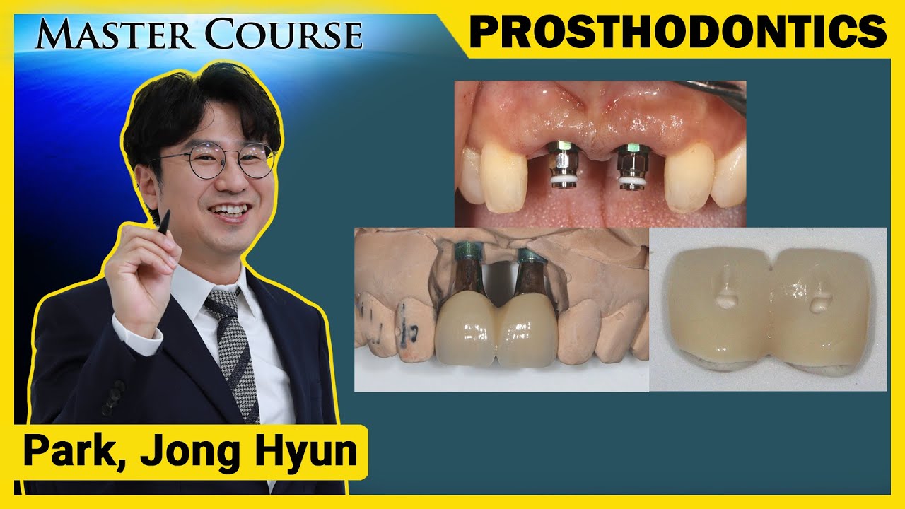 [Master Course Season2 -PROSTHODONTICS] Aesthetic Impression Taking in the Anterior Region
