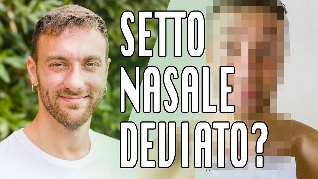 Rinosettoplastica con Pietro Palma | Setto nasale deviato | L'esperienza di Ale demaria
