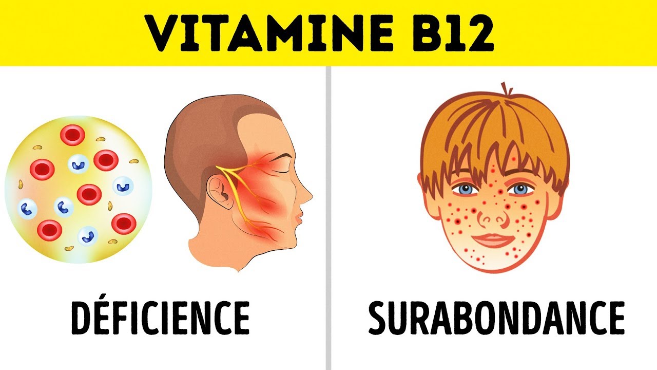 Avant de Commencer à Prendre des Vitamines, Regarde Cette Vidéo Pour Éviter D’avoir Des Problèmes