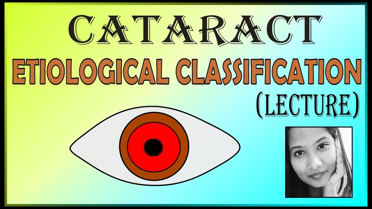 Etiological Classification of Cataract | Cataract Causes | Ophthalmology Lectures