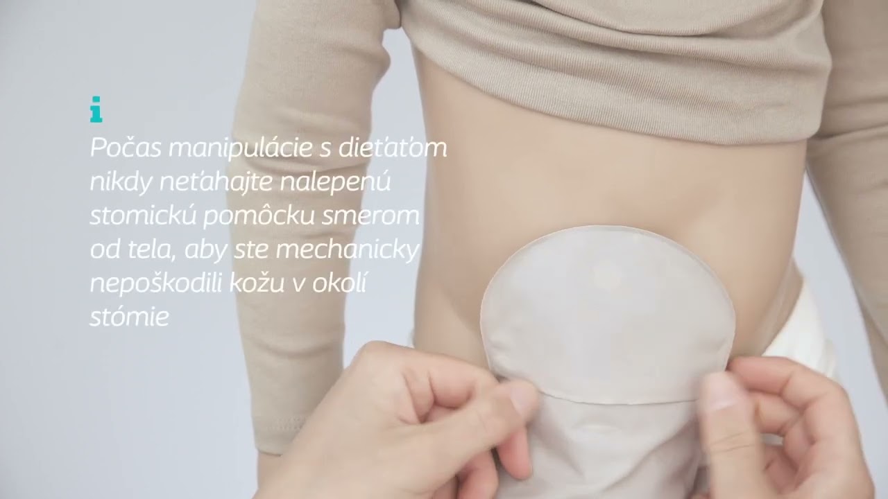 SenSura® Mio Kids 1-dielne stomické výpustné vrecká - Návod