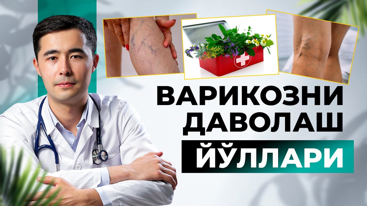 ВАРИКОЗ КАСАЛЛИГИ САБАБИ ВА ДАВОЛАШ