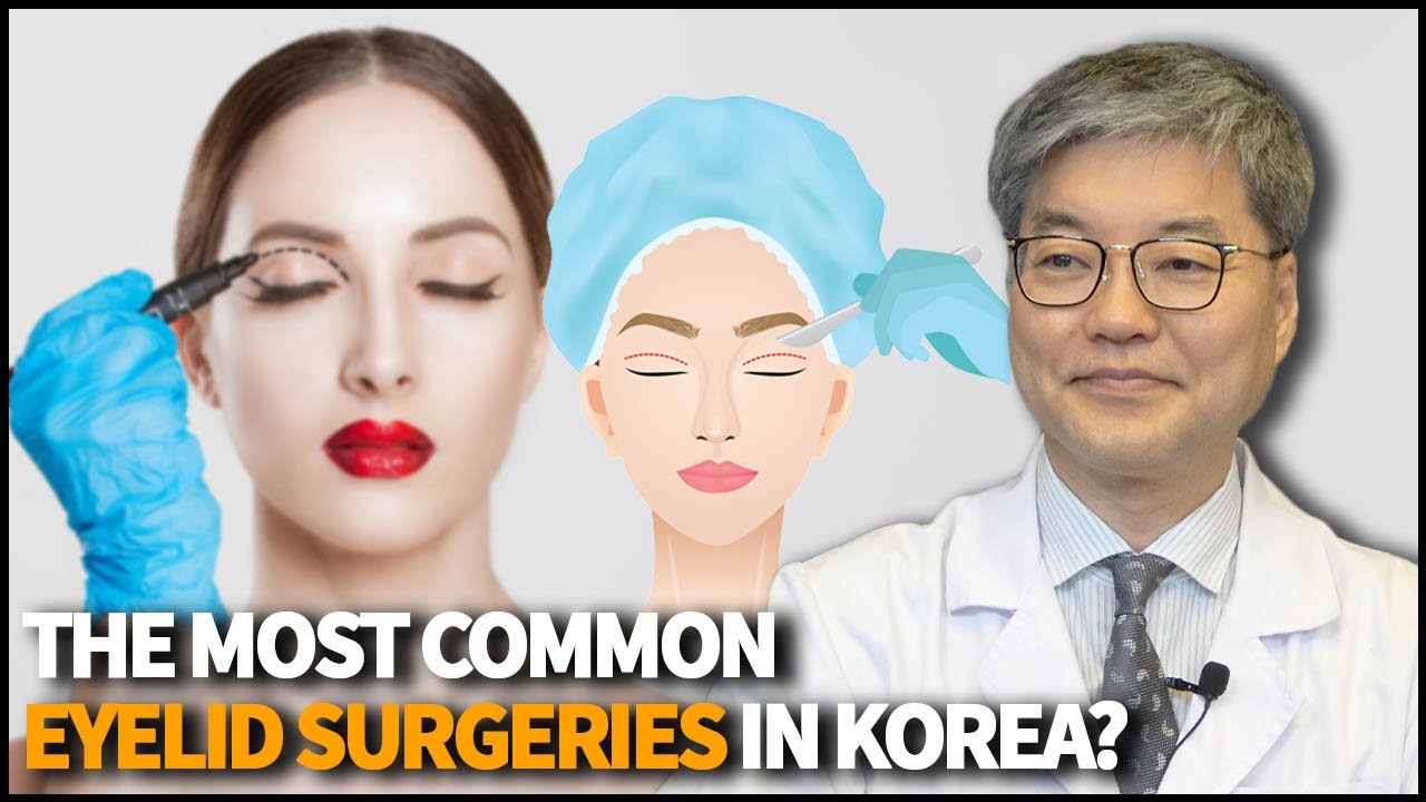 What are the most common eyelid surgeries in Korea?