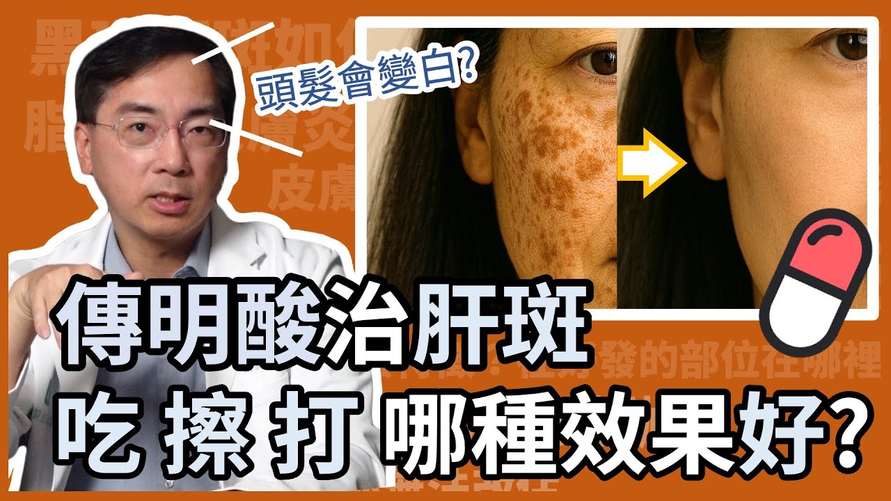 吃傳明酸治療肝斑，頭髮會變白？吃的、擦的、注射的，哪一種效果最好？