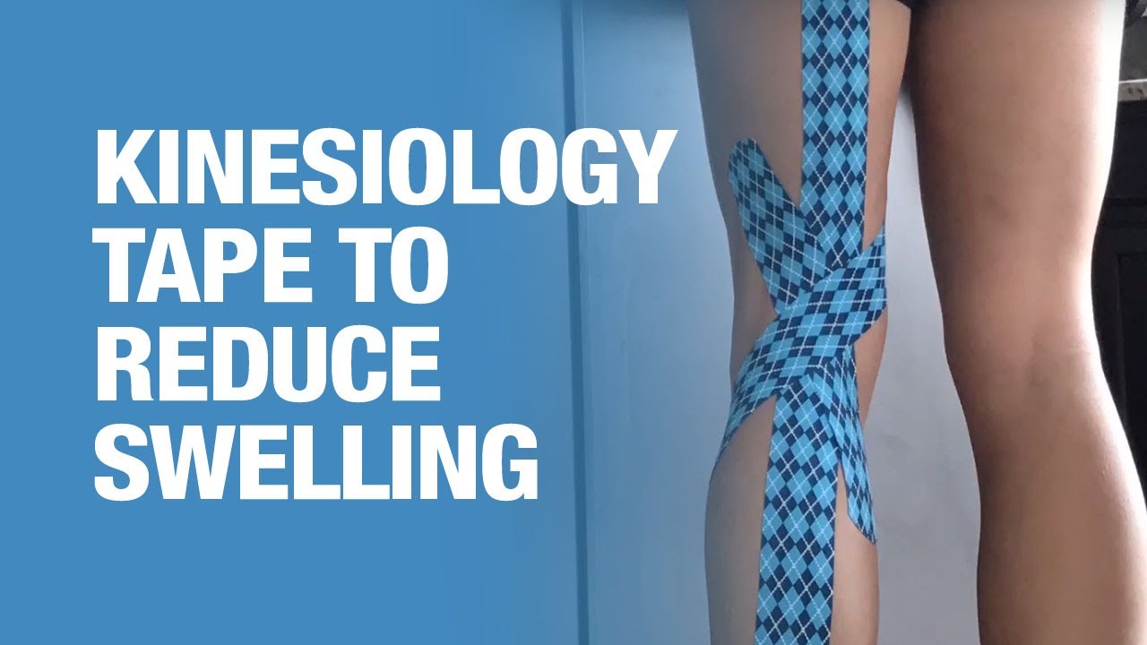 Taping to Reduce Swelling | RunToTheFinish