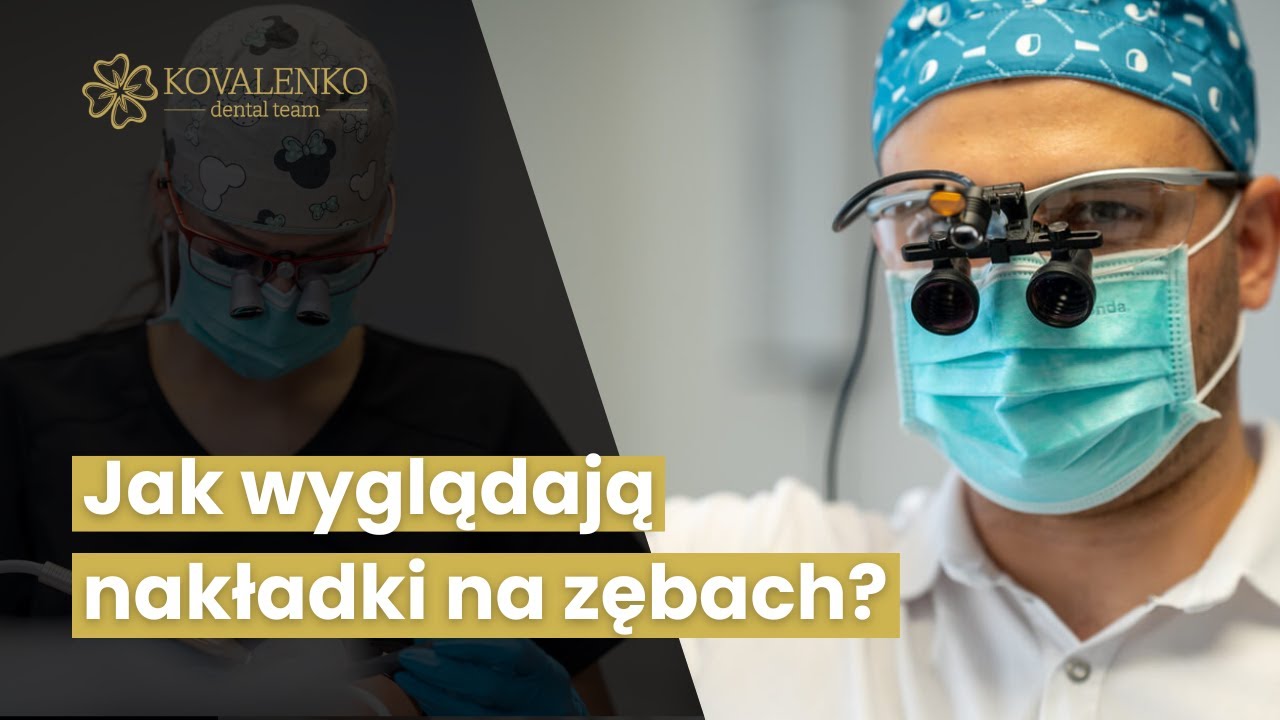 Jak Wyglądają Nakładki Na Zębach? - Kovalenko Dental Team Koszalin