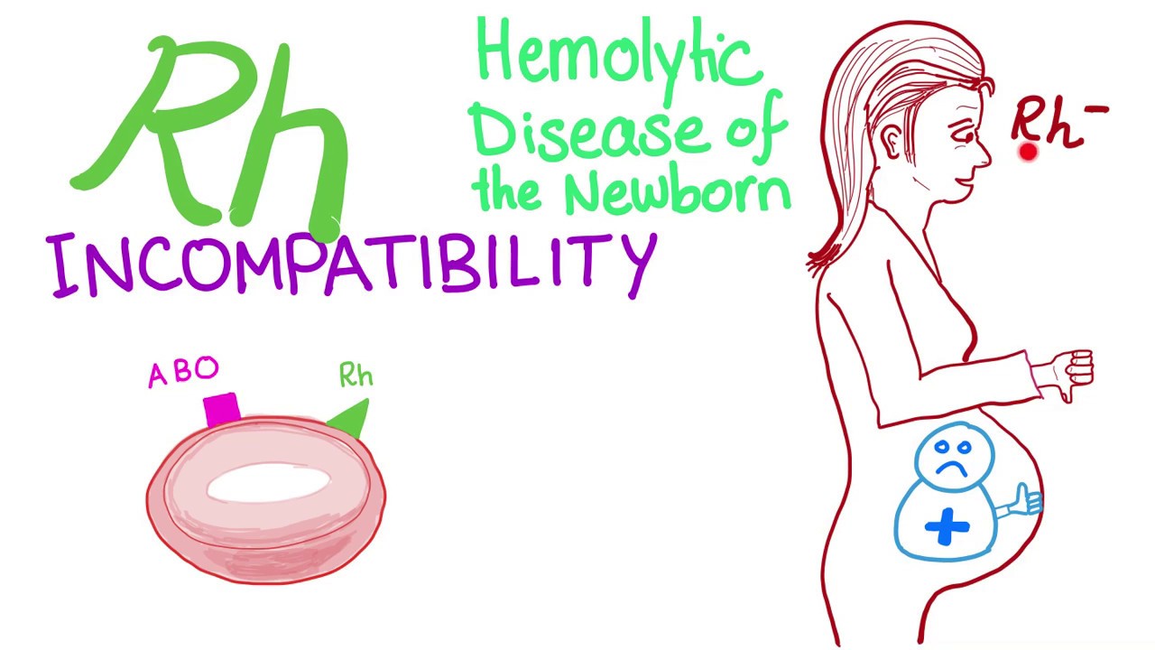 Rh incompatibility - Hemolytic disease of the newborn (HDN) - Erythroblastosis fetalis - Hemolysis