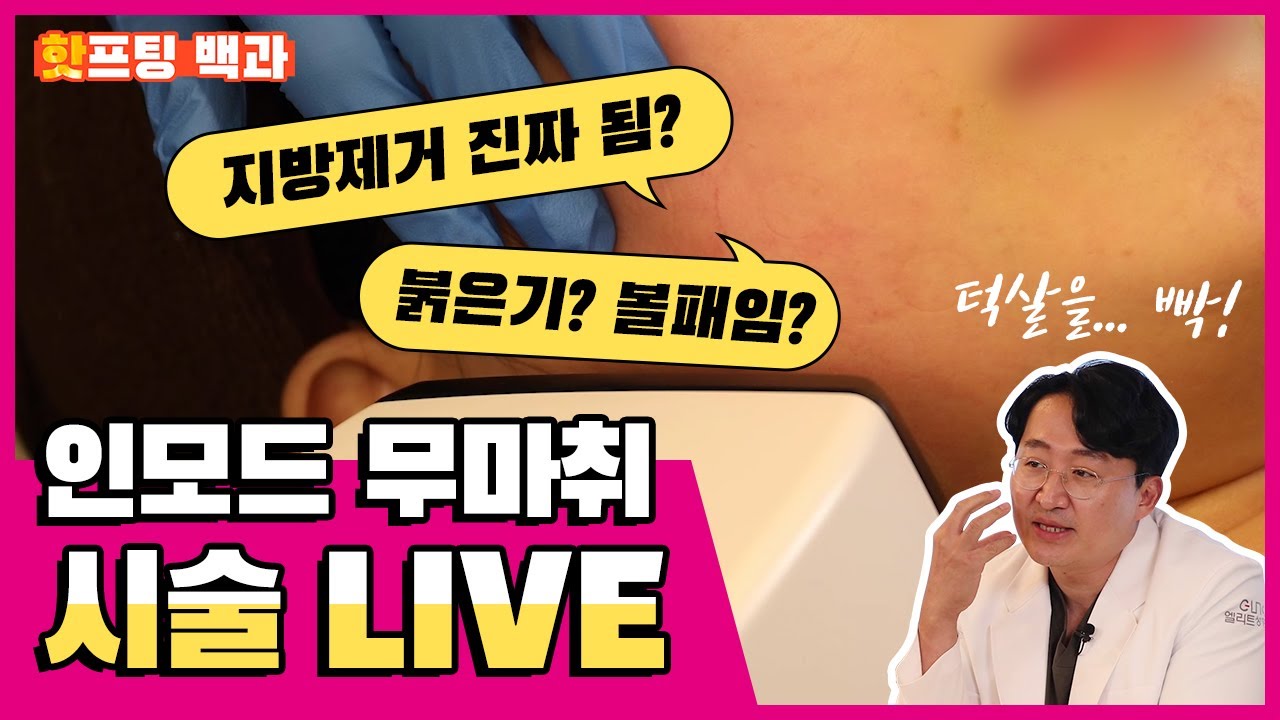 지방 빼는 리프팅?! 인모드 원리부터 통증 붉은기 알고 받자