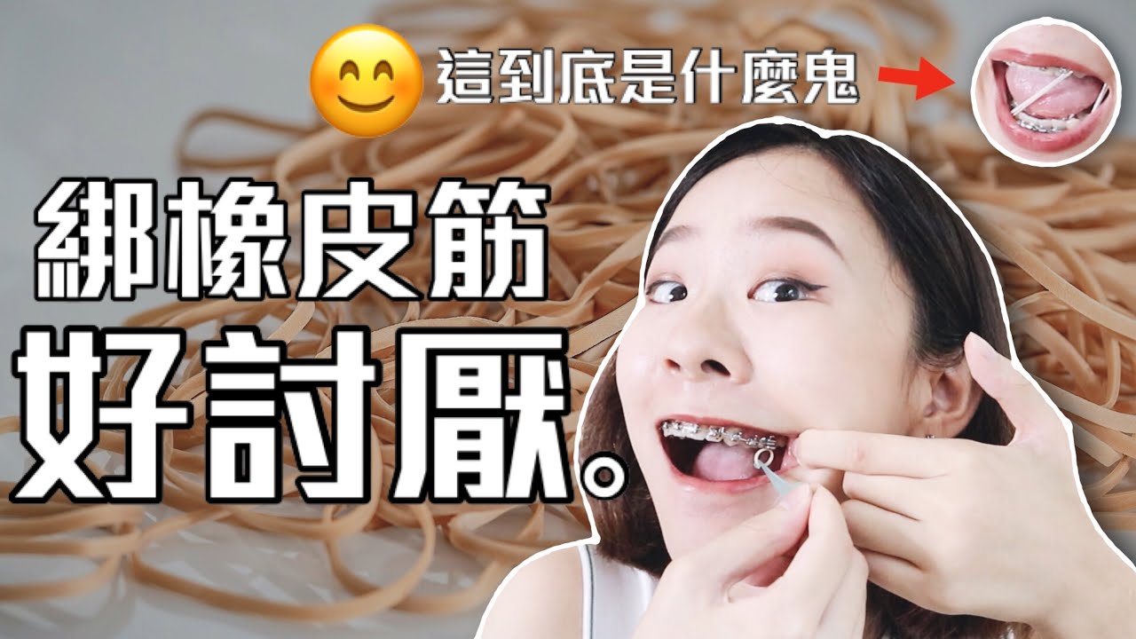 牙齒矯正兩年心得之『我竟然要戴牙套橡皮筋？！😰』會痛嗎？要怎麼吃飯？橡皮筋怎麼戴？｜桑潔牙套日記＃2