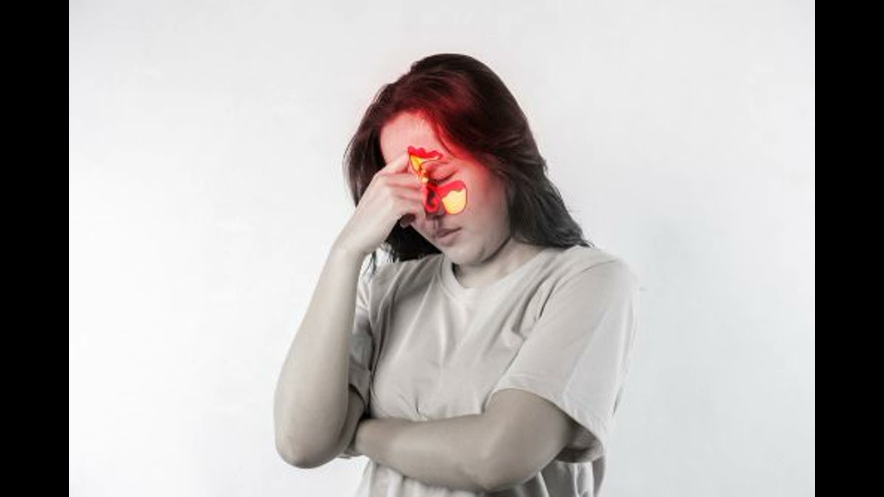 La sinusite, inflammation des sinus de la face