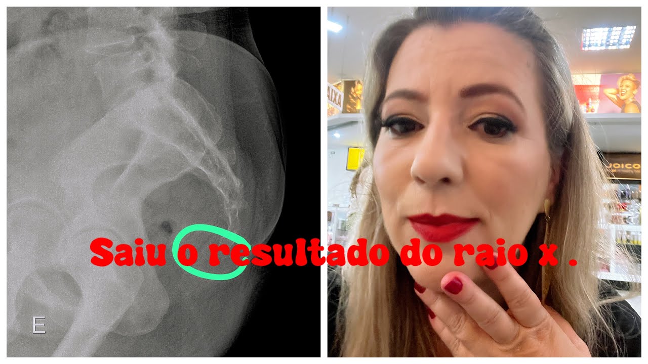 AS COISAS NÃO ANDAM NADA BEM POR AQUI! Saga continua 😩