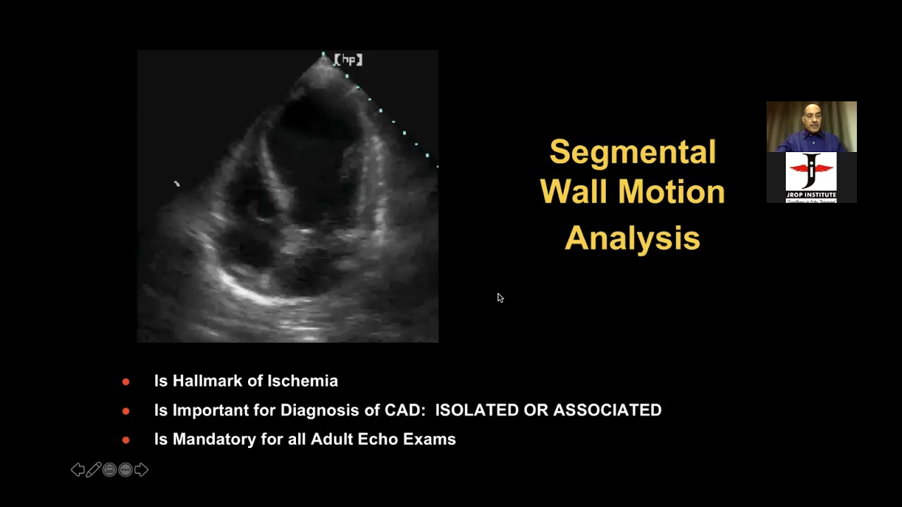 SYSTOLIC FUNCTION BY DR SANJAY MITTAL 14 11 2021