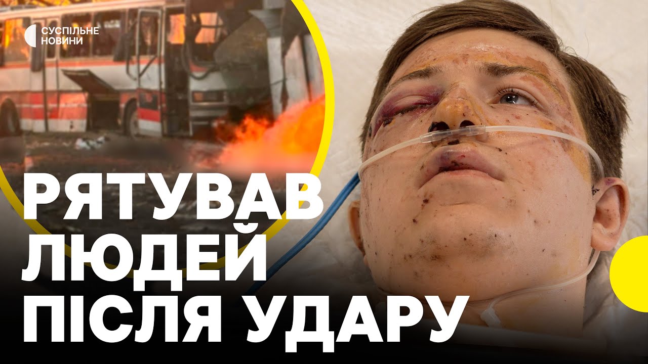 Вижив після удару по АВТОБУСУ З ШАХТАРЯМИ  | “Витягував людей з автобуса, що палав”